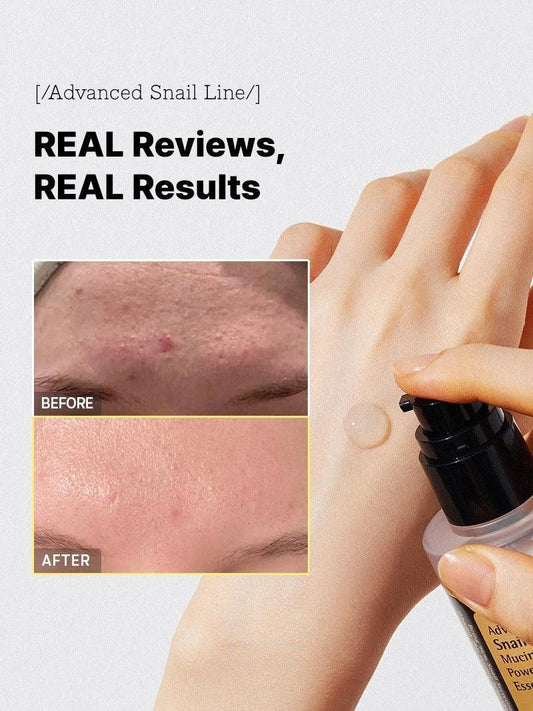 Snail 96 Mucin Power Essence 100 Ml (Buy 1 get 1 Free )